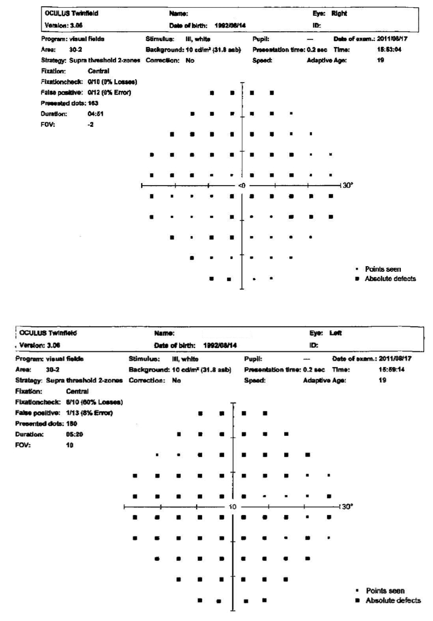 Visual Field Testing Note Visual Field Testing: Fast and Accurate Results - M&S Technologies